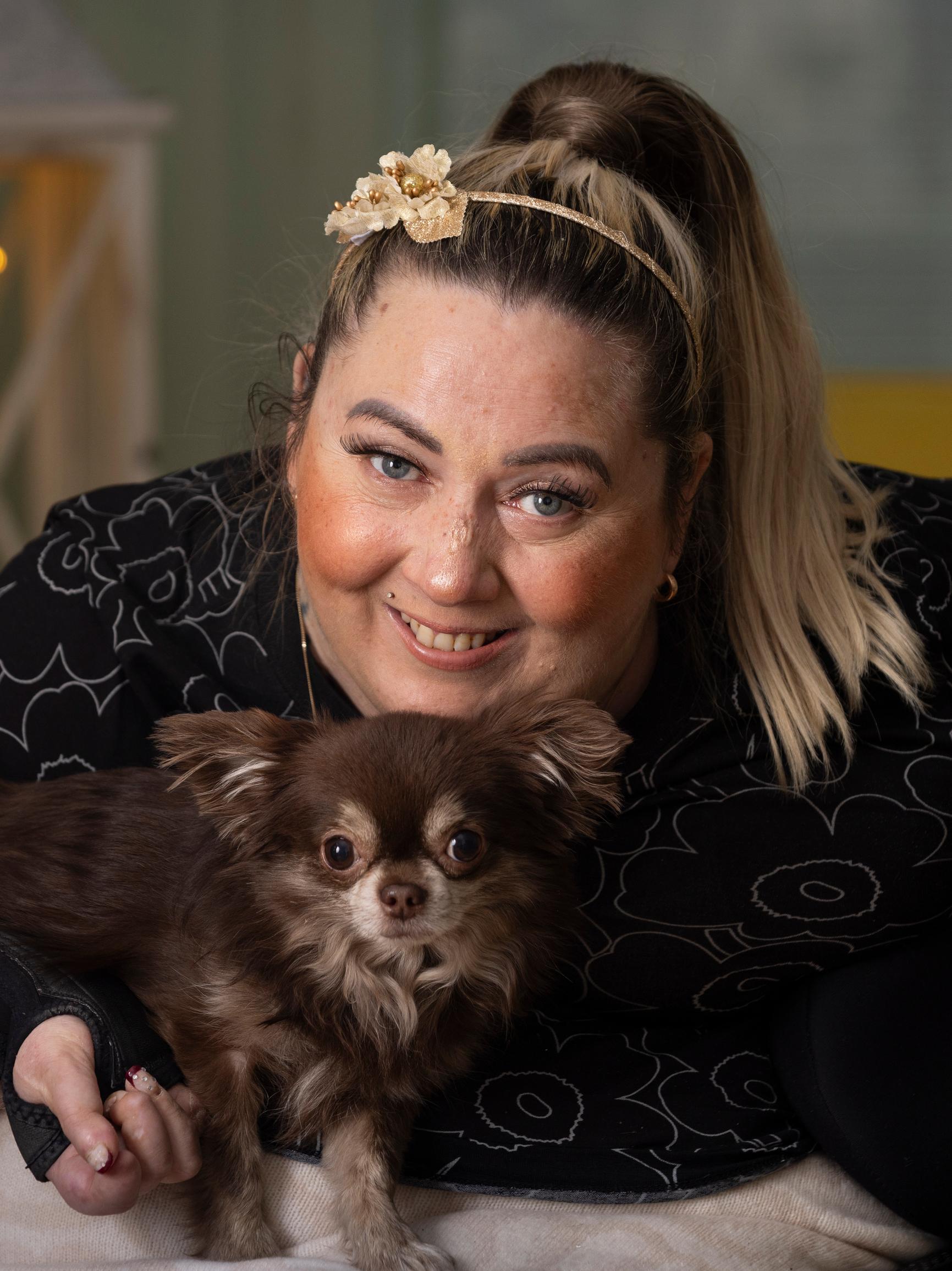 Johanna Talamo putosi 16-vuotiaana parvekkeelta ja sai neliraajahalvauksen – Hän pakeni huumeisiin, joita kaverit auttoivat vetämään