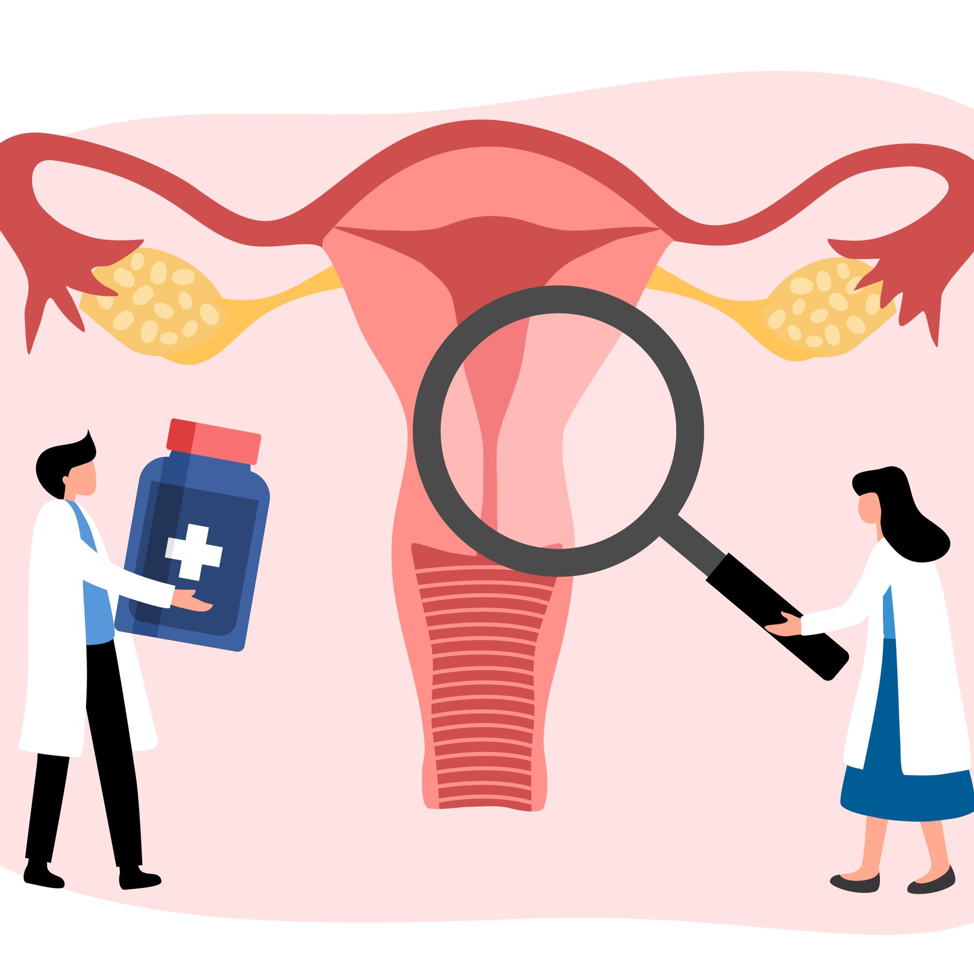 Klamydia ei näy papakokeessa – Lääkäri kertoo, milloin tartunnan mahdollisuus on syytä selvittää laboratoriokokeella