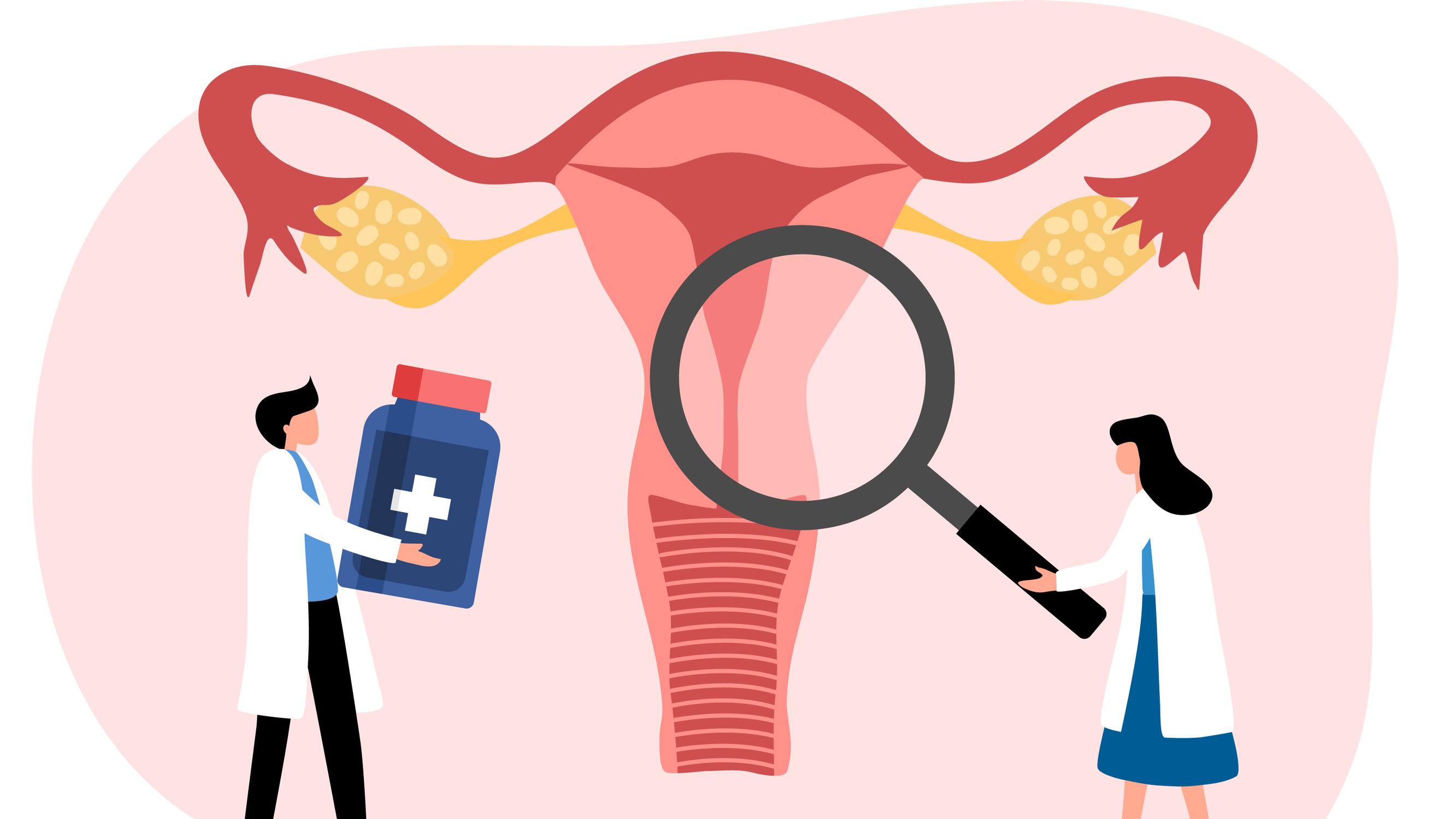 Klamydia ei näy papakokeessa – Lääkäri kertoo, milloin tartunnan mahdollisuus on syytä selvittää laboratoriokokeella