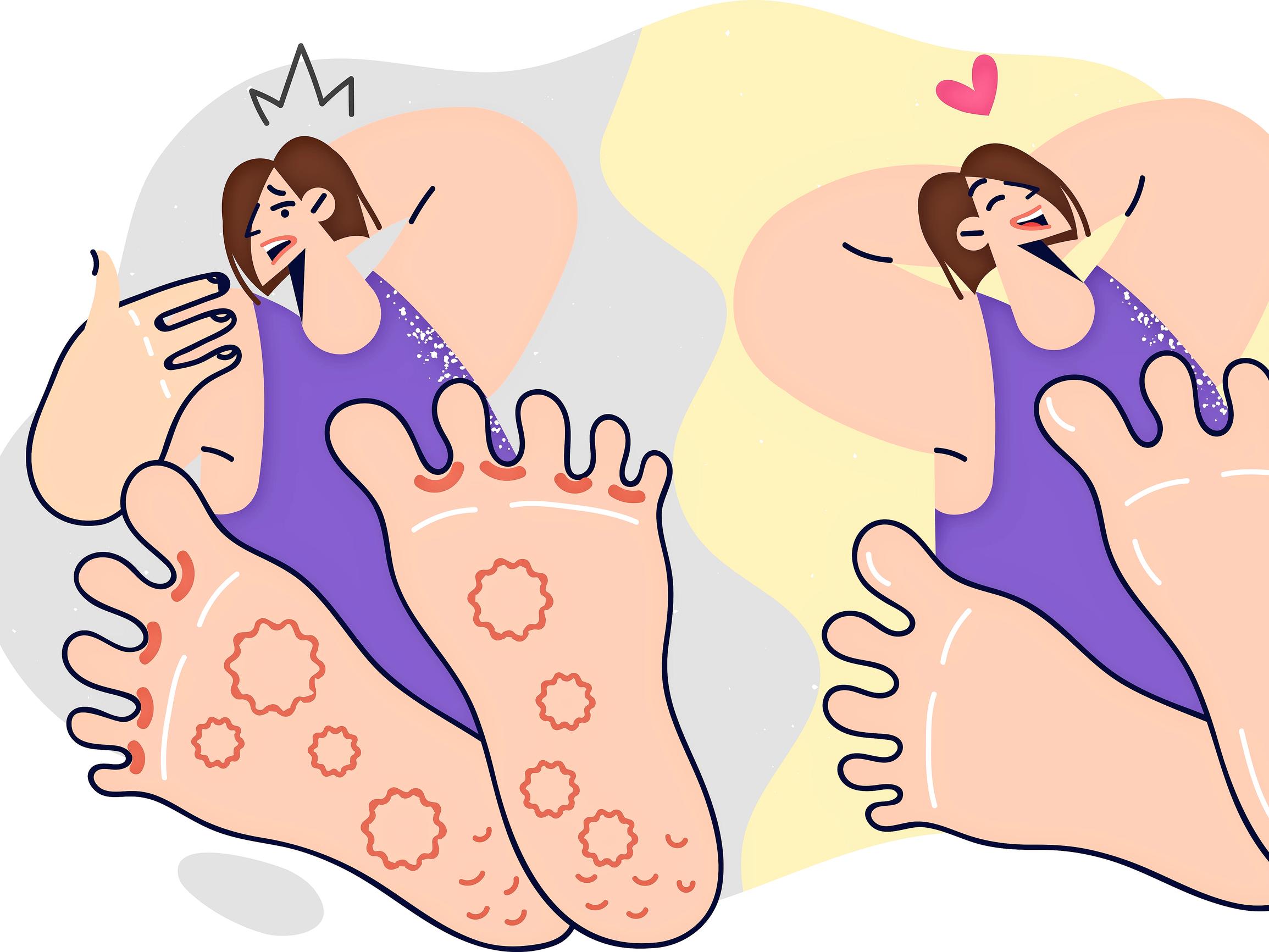 Pistelyä, kihelmöintiä ja puutumista jaloissa: Pippa Laukka kertoo, miten diabeettinen neuropatia etenee ja kuinka hermoston oireilua voi ehkäistä ja hoitaa