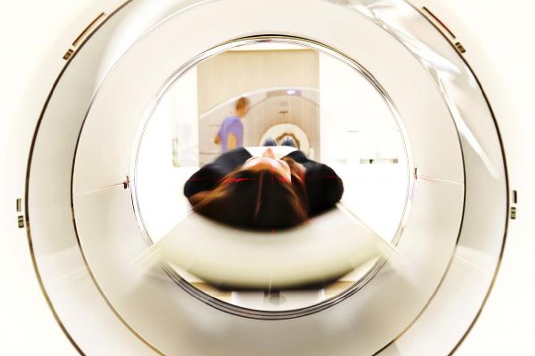 Kiminkinen Vastaa Epilepsiapotilaan Kysymyksiin Apu