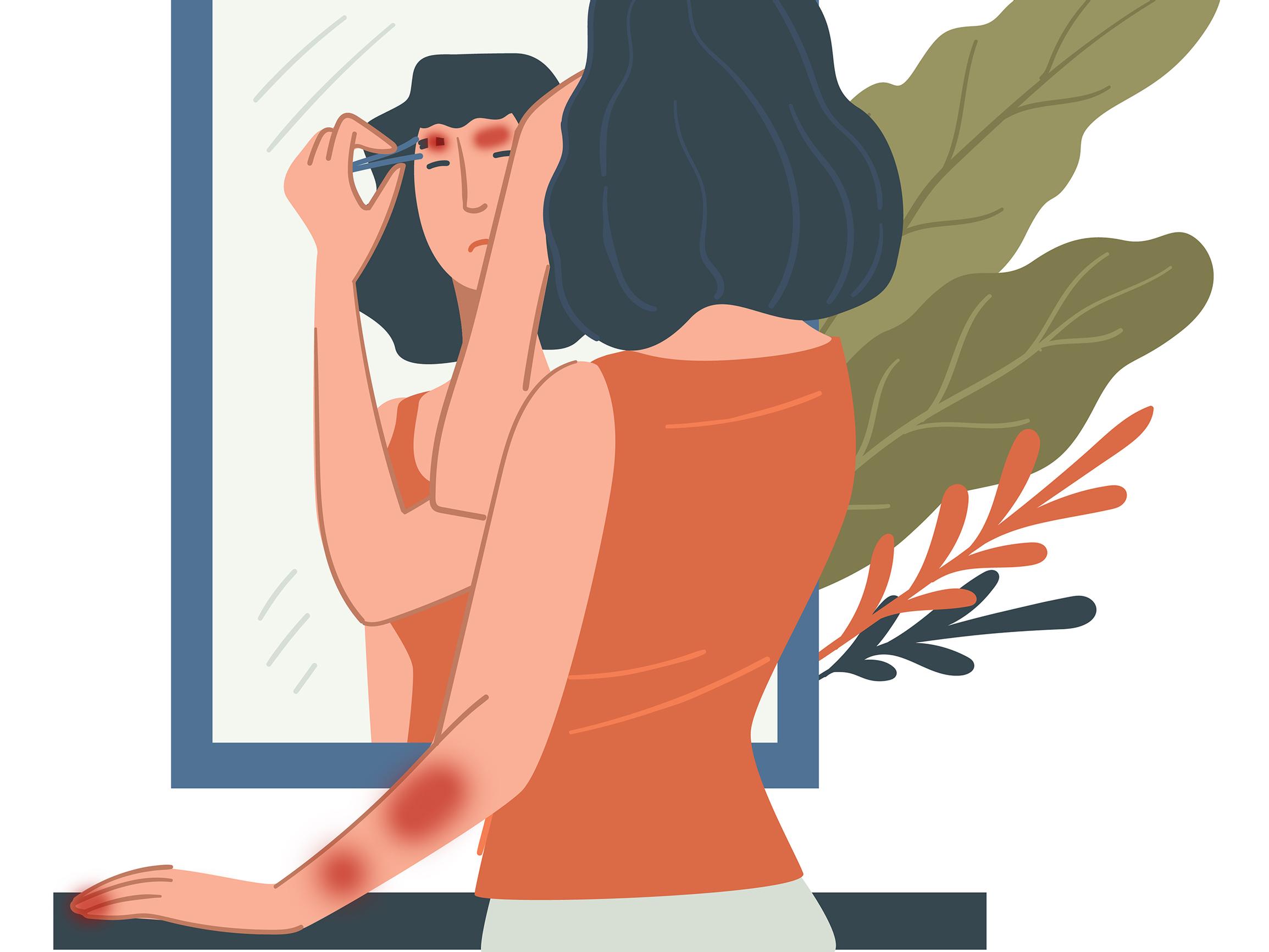 Nypin ihokarvojani pakonomaisesti – Miten saisin ongelman hallintaan?