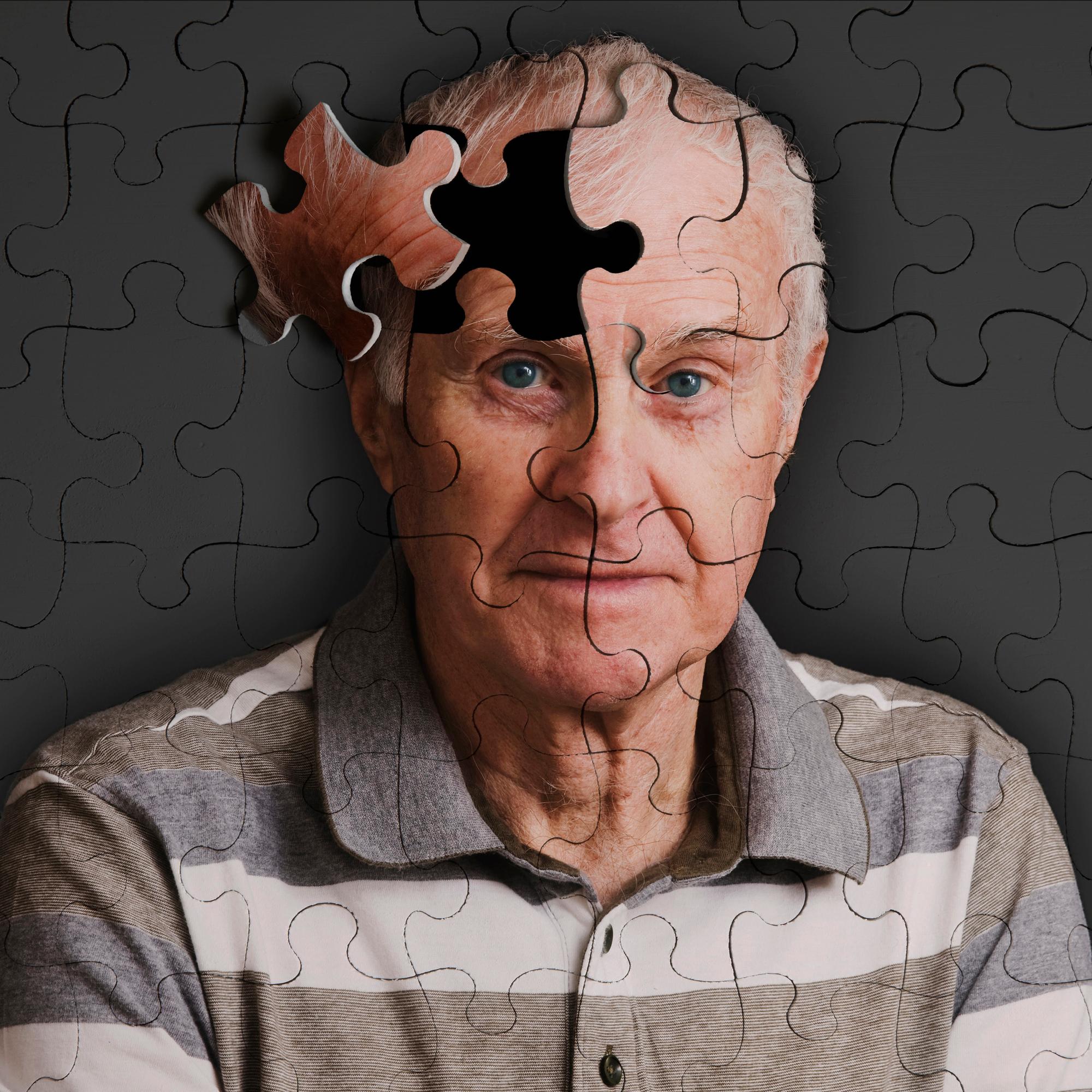 Sirpaleinen vuorokausirytmi voi altistaa Alzheimerin taudille – Nauruhoito auttaa kuiviin silmiin