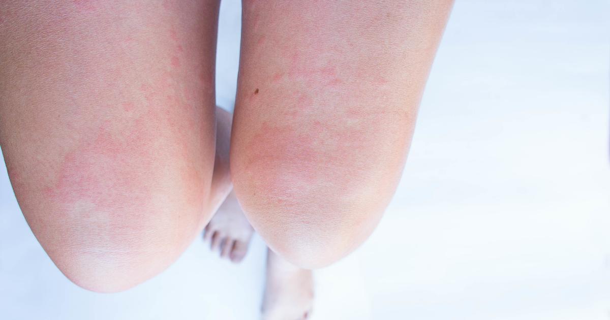 Punaj k l On Jyll nnyt Vuosikausia Mik Avuksi Kiminkinen Apu punaj-k-l-on-jyll-nnyt-vuosikausia-mik-avuksi-kiminkinen-apu