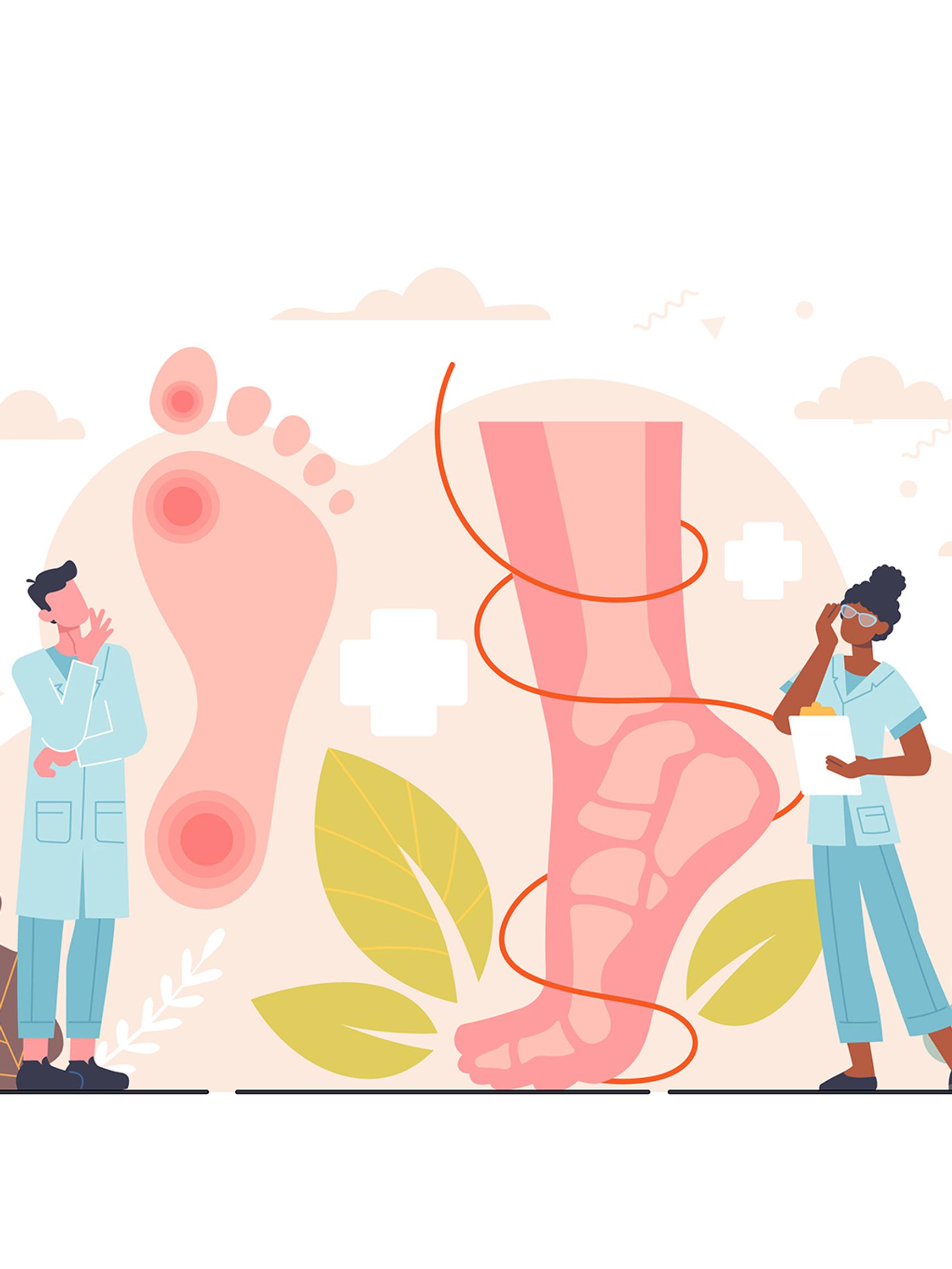 Yöllinen särky jaloissa kiusaa – Taustalla suonikohjuleikkaus – Pippa Laukka kertoo, mistä on kyse