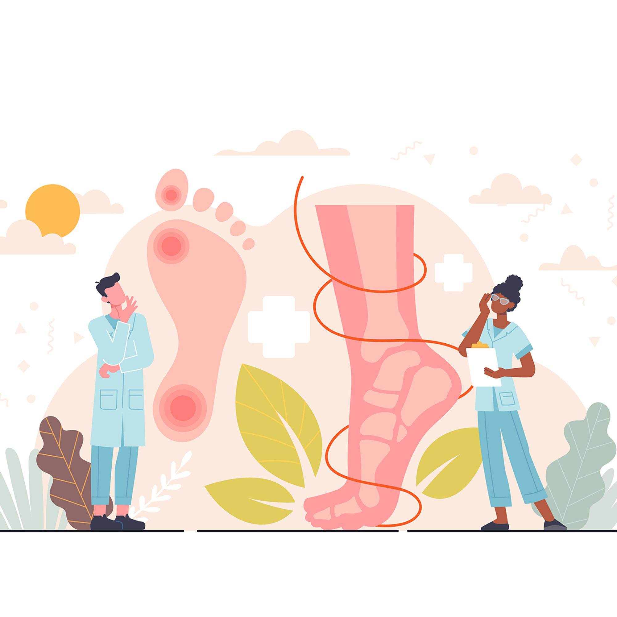 Yöllinen särky jaloissa kiusaa – Taustalla suonikohjuleikkaus – Pippa Laukka kertoo, mistä on kyse