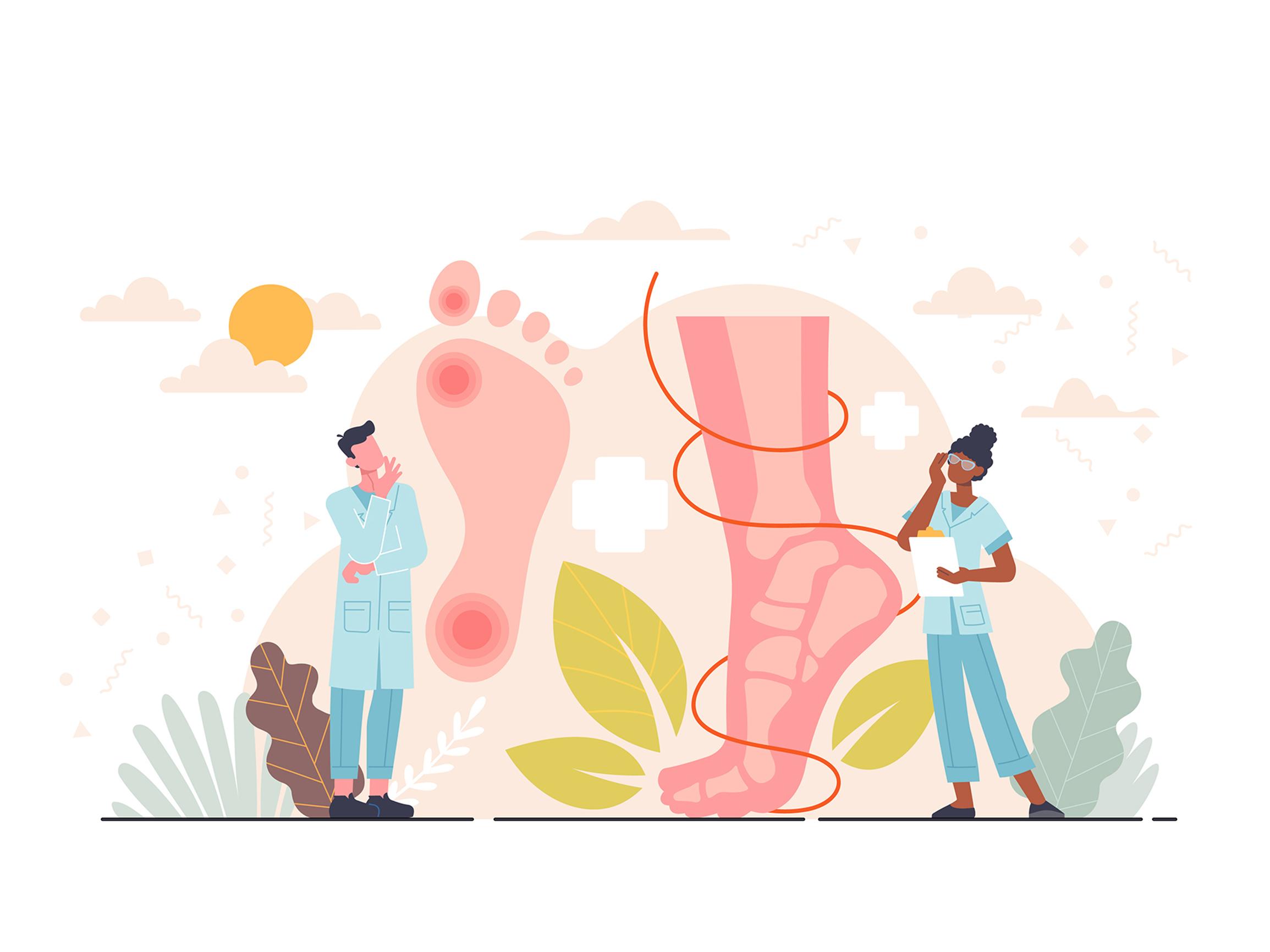 Yöllinen särky jaloissa kiusaa – Taustalla suonikohjuleikkaus – Pippa Laukka kertoo, mistä on kyse