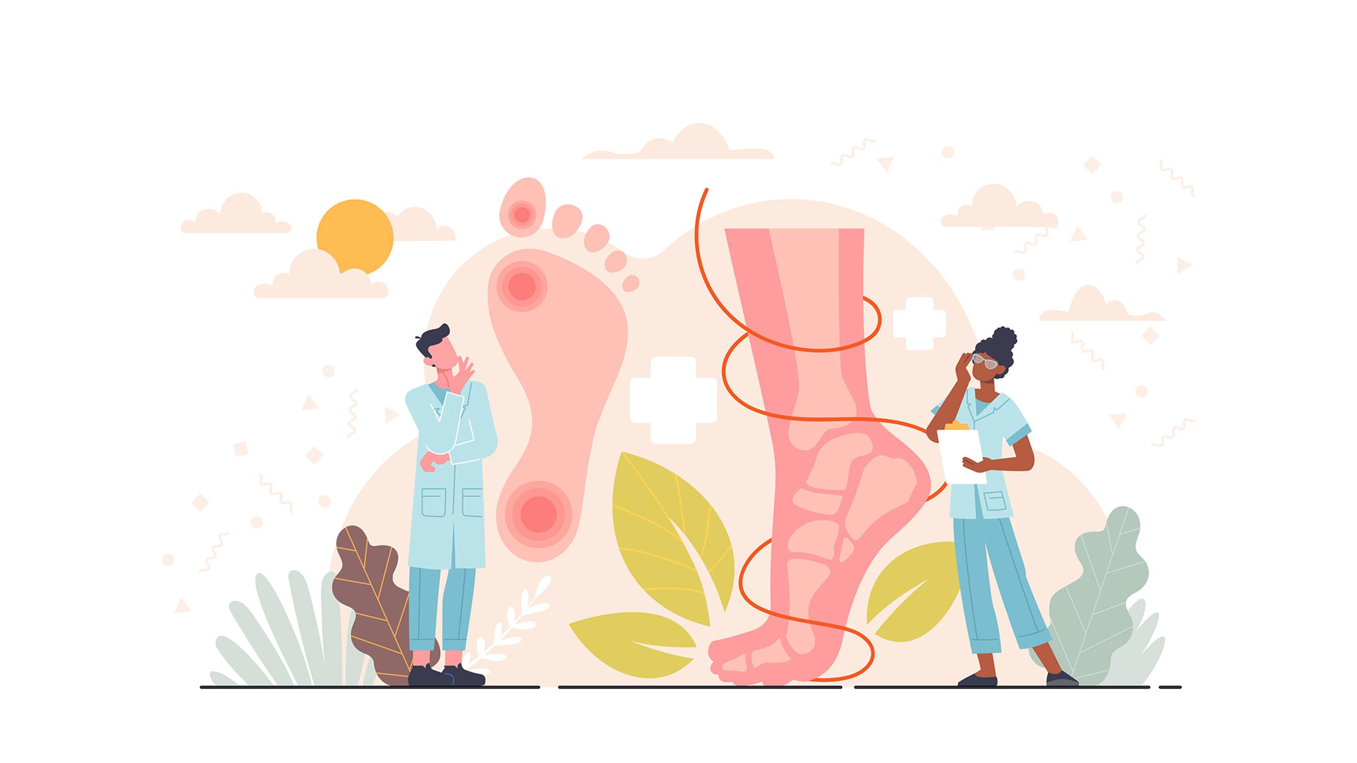 Yöllinen särky jaloissa kiusaa – Taustalla suonikohjuleikkaus – Pippa Laukka kertoo, mistä on kyse