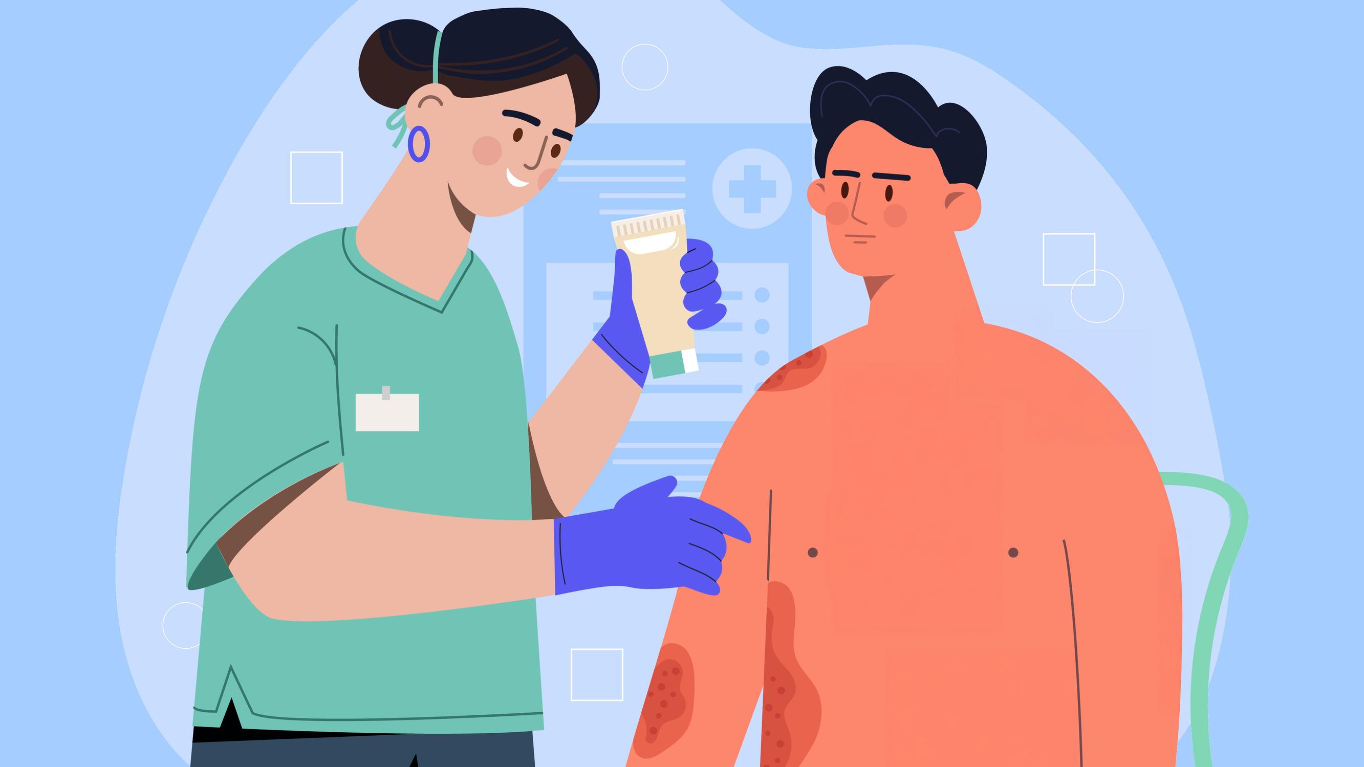 Vyöruusukipu on jatkunut neljä viikkoa – Uskaltaako vielä lähteä kuntosalille? – Lääkärillä on selvä näkemys