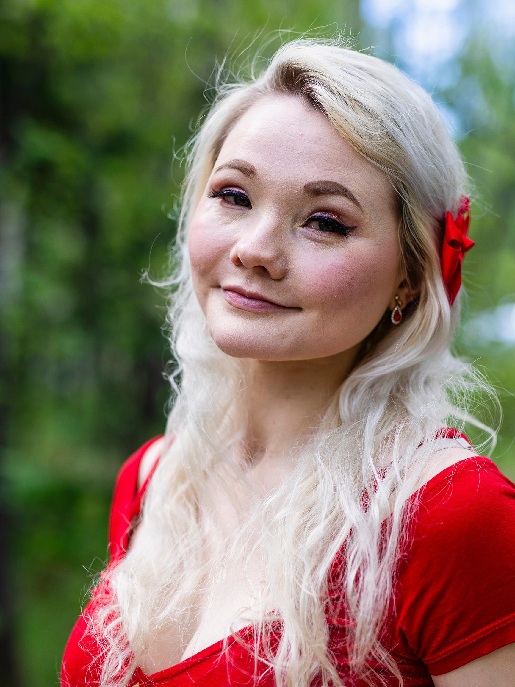 Laura, 17, nousi bussista ja sitten kaikki pimeni – Heräsi sairaalassa ilman toista jalkaansa ja kasvot murskana