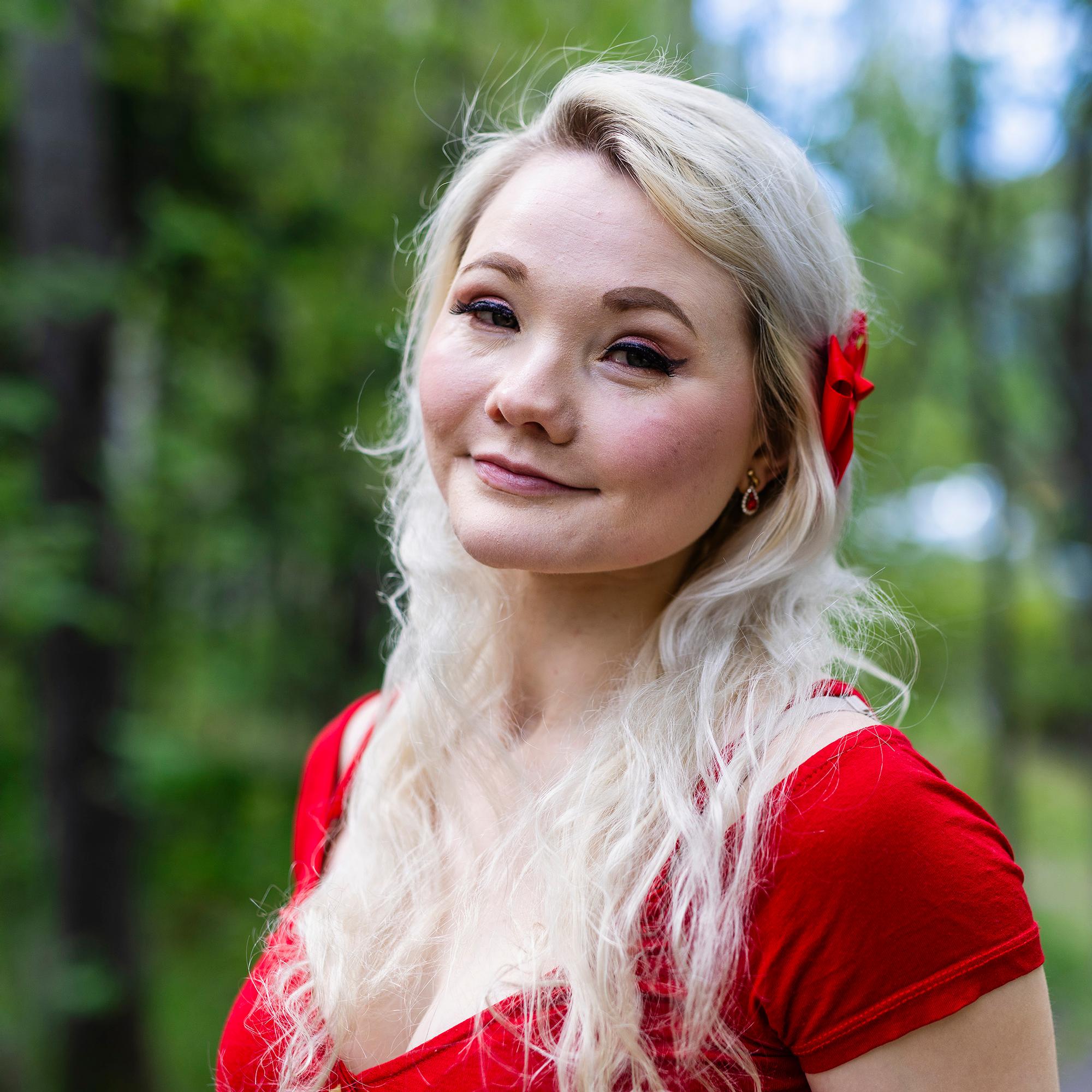 Laura, 17, nousi bussista ja sitten kaikki pimeni – Heräsi sairaalassa ilman toista jalkaansa ja kasvot murskana