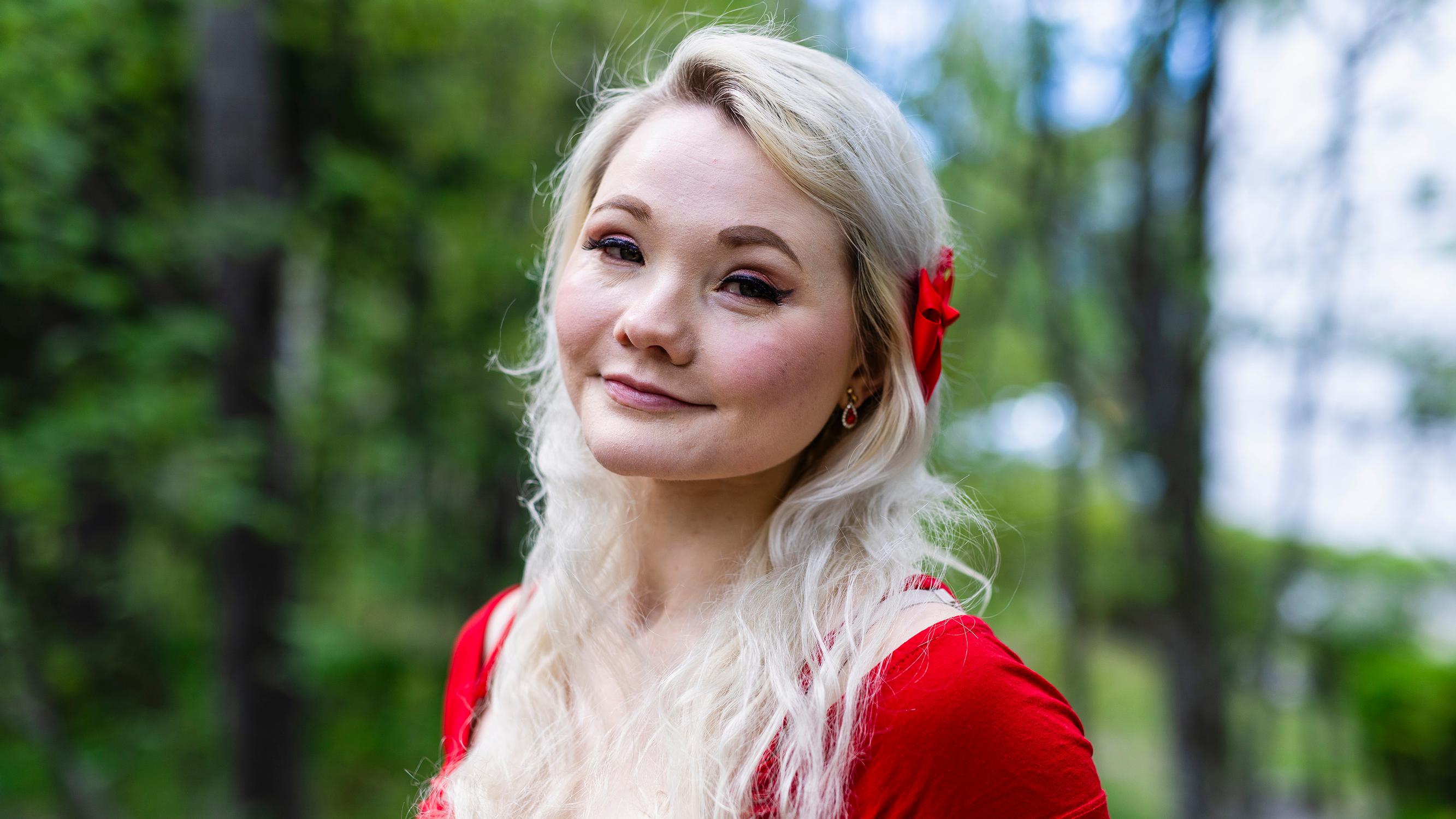 Laura, 17, nousi bussista ja sitten kaikki pimeni – Heräsi sairaalassa ilman toista jalkaansa ja kasvot murskana