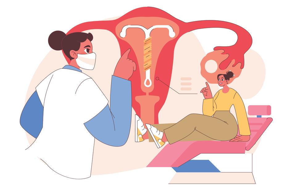 Hormonikierukka | Lopettaako se vuodot kokonaan? | Kuukautiset | Apu