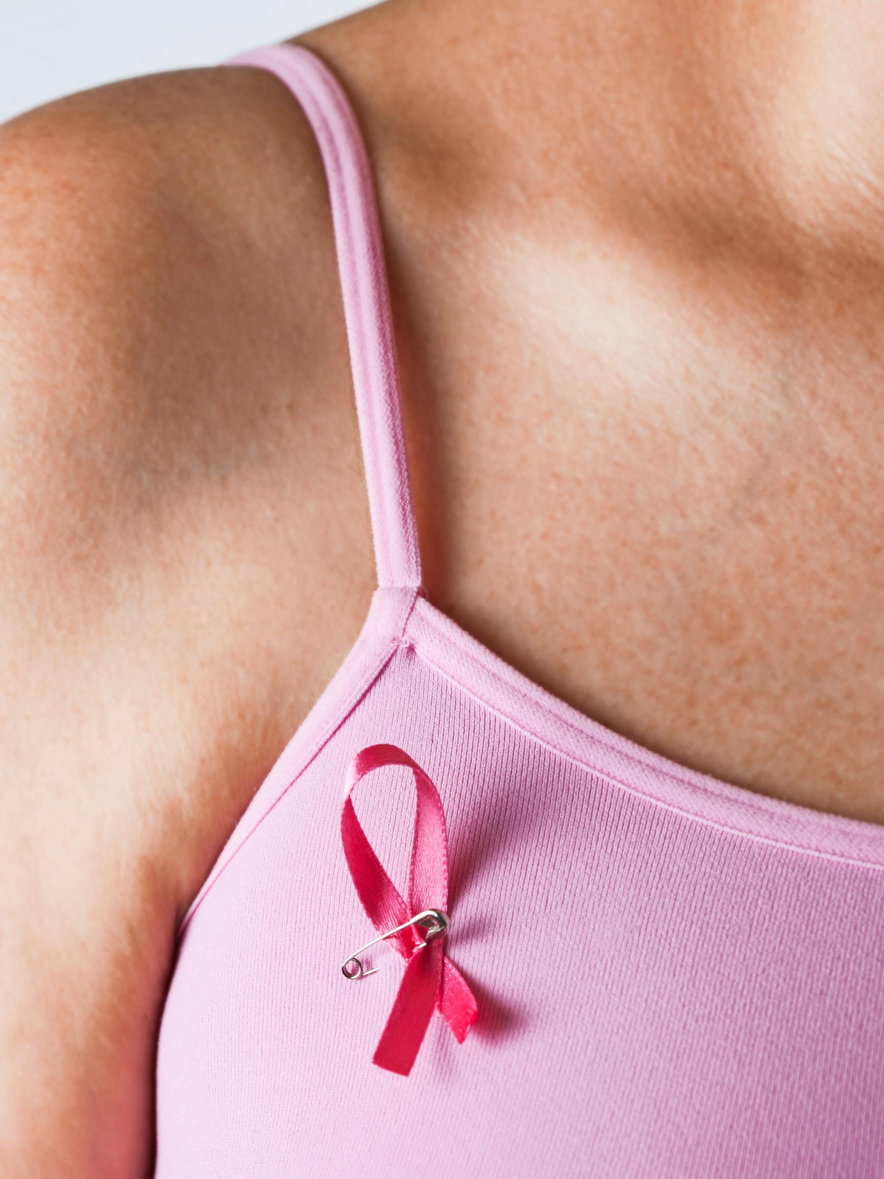 Tekoäly tehostaa mammografiaseulontaa – TIA-kohtaus suurentaa aivoverenkiertohäiriöiden riskiä vuosikausiksi