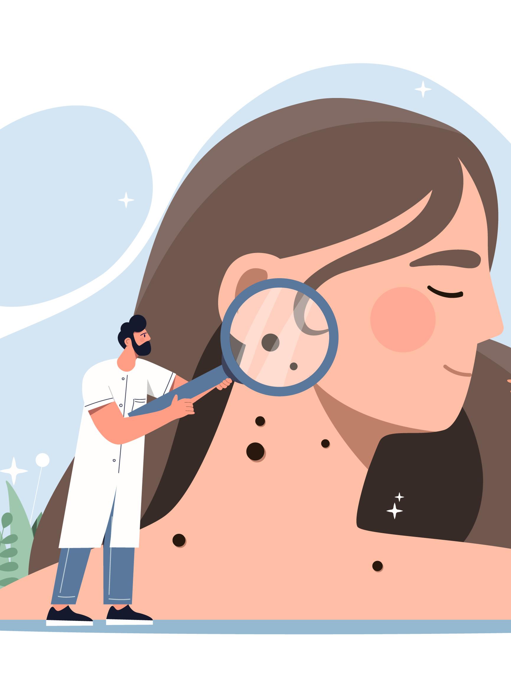 Tunnistatko hälyttävät ihomuutokset? – Syynää myös jalkapohjat ja päänahka – Ihotautilääkärin viisi vinkkiä