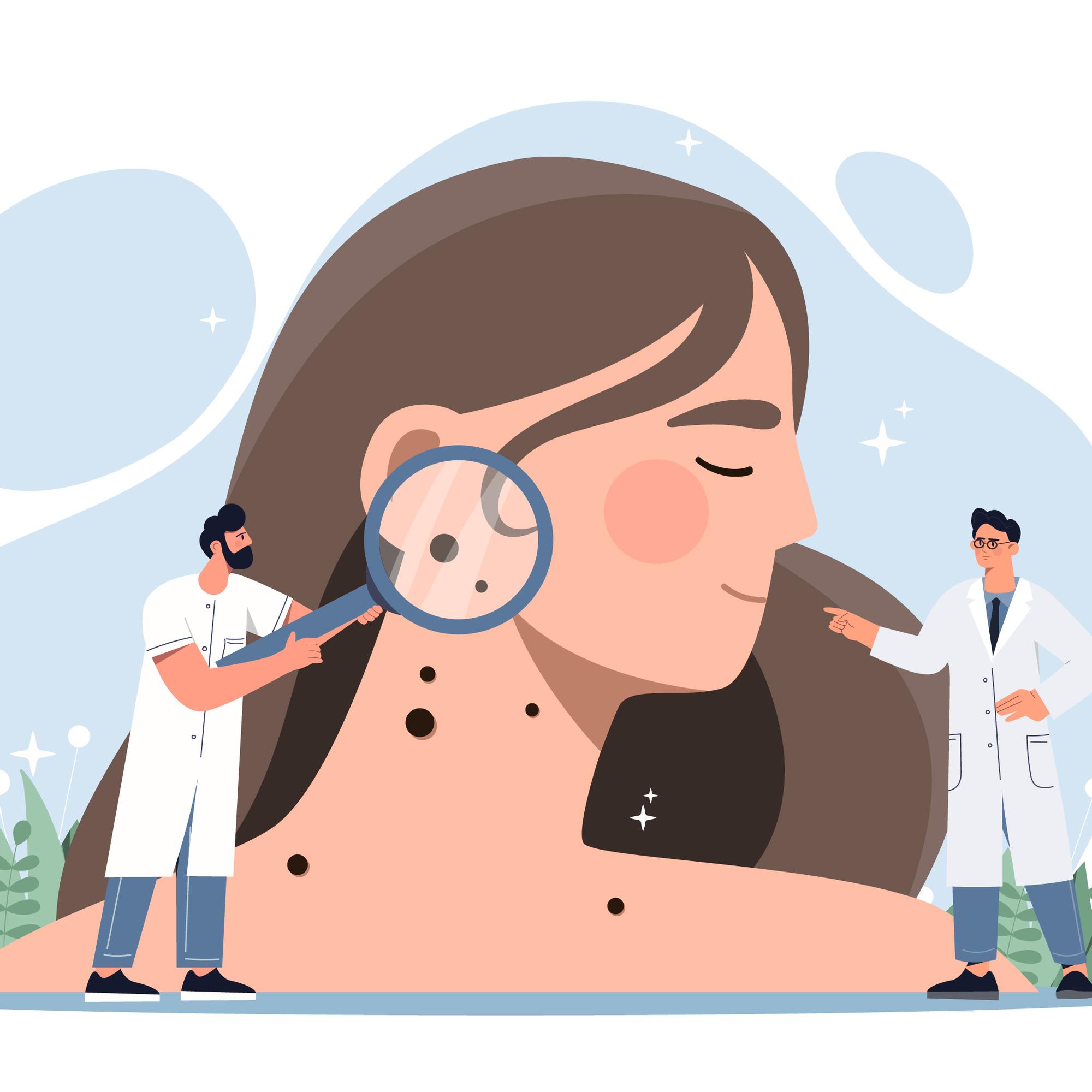 Tunnistatko hälyttävät ihomuutokset? – Syynää myös jalkapohjat ja päänahka – Ihotautilääkärin viisi vinkkiä