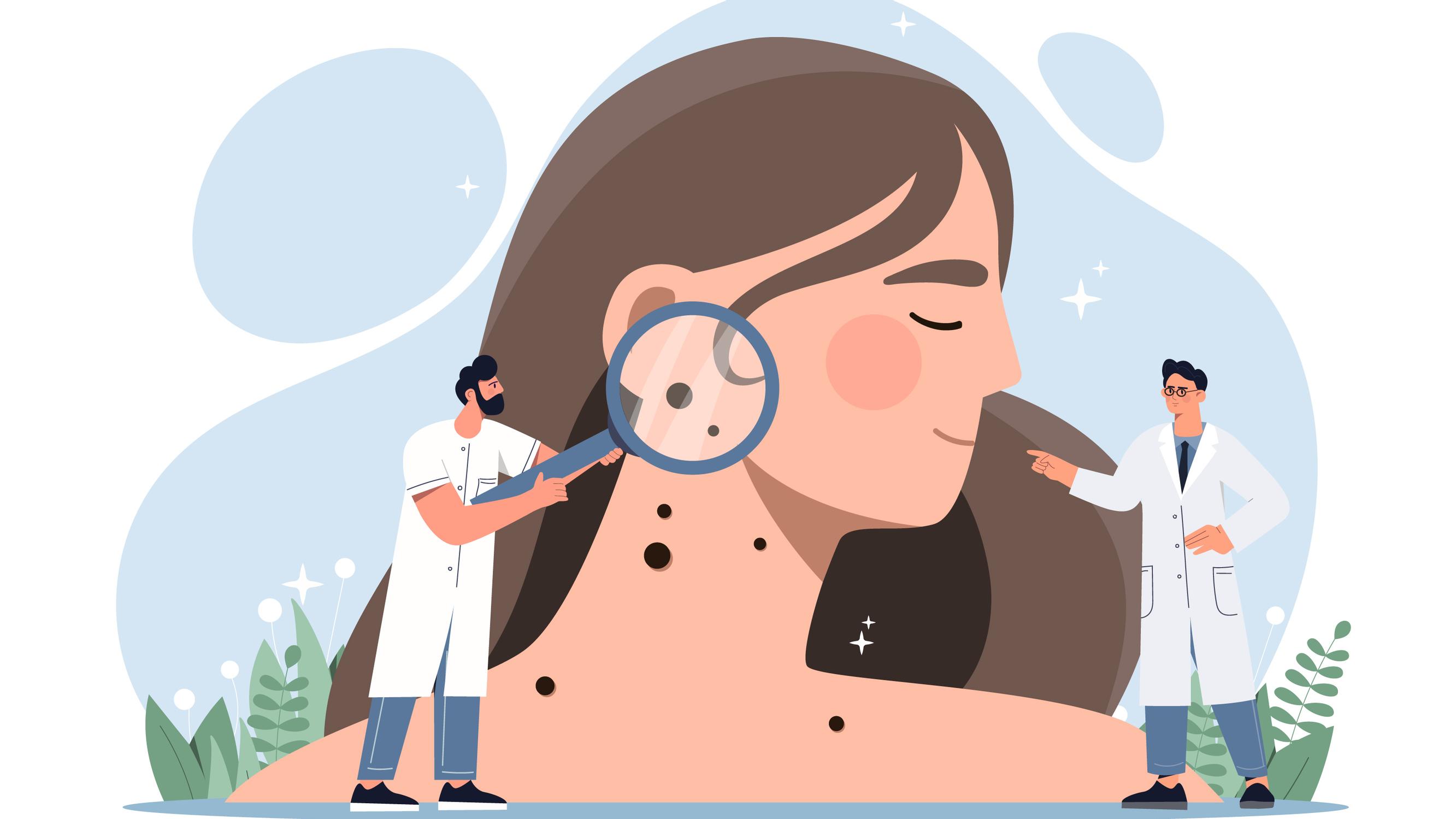 Tunnistatko hälyttävät ihomuutokset? – Syynää myös jalkapohjat ja päänahka – Ihotautilääkärin viisi vinkkiä