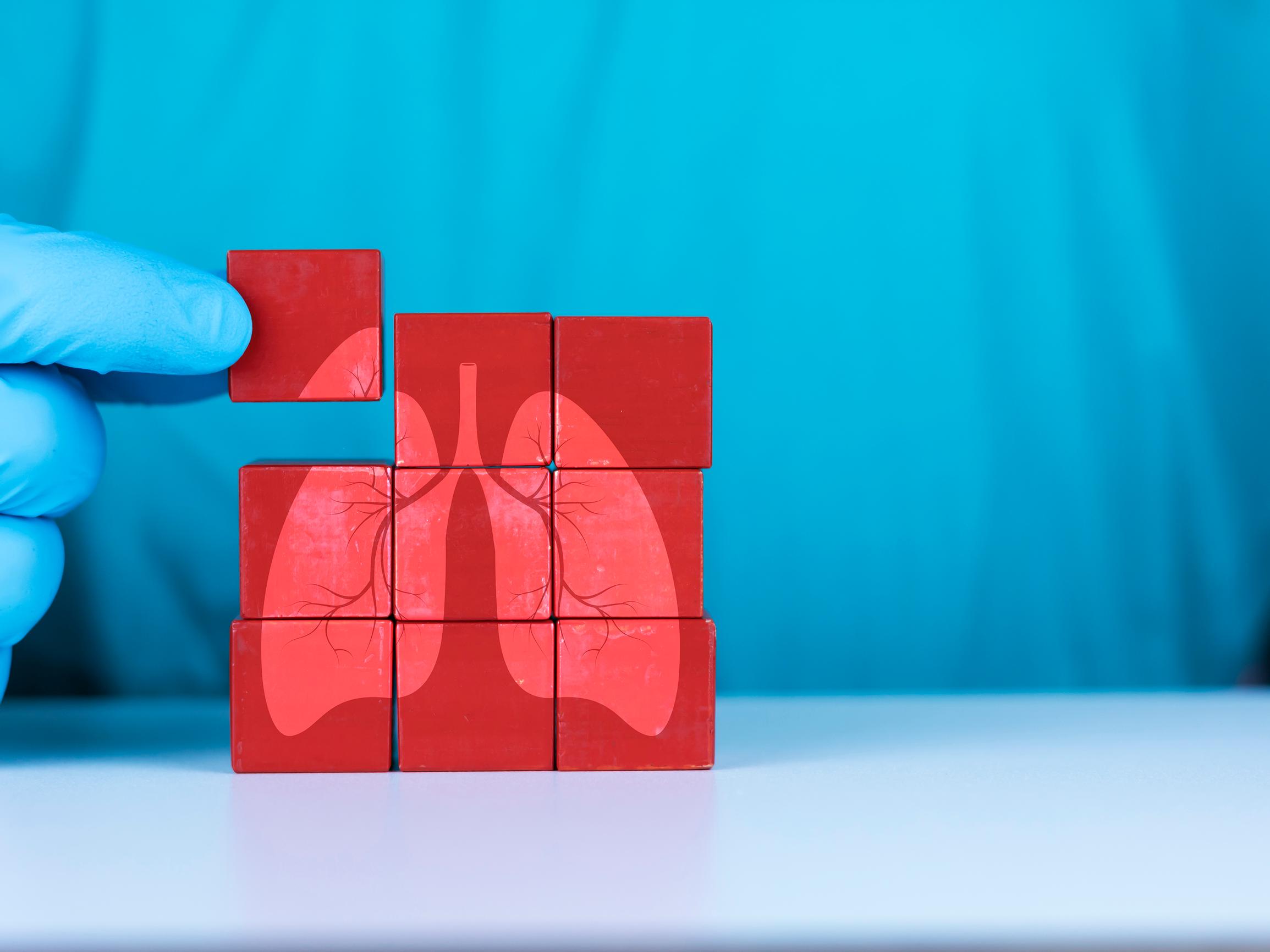 Ylilääkäri: Tuberkuloosin riskialueilta Suomeen töihin tulevia täytyy seuloa