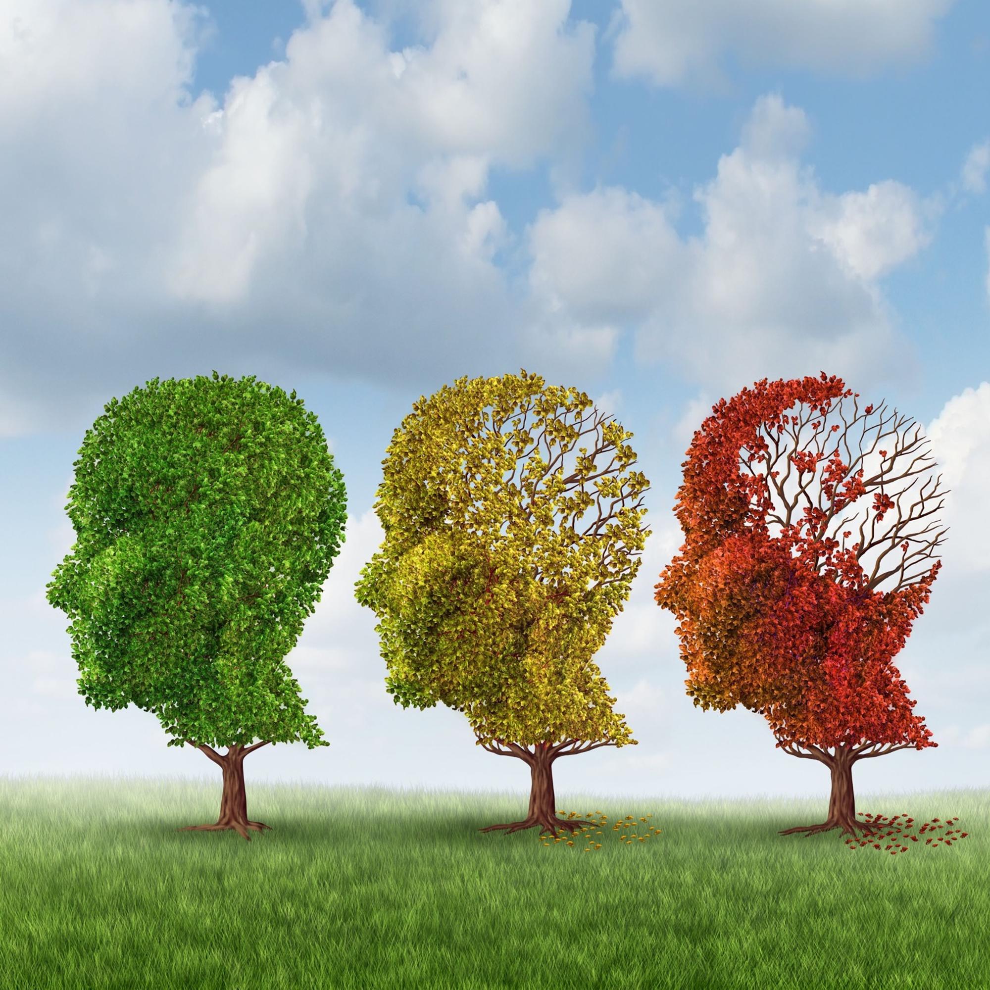 Alzheimer aiheuttaa muistinmenetystä
